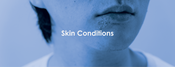 urgent care skin condition treatment
